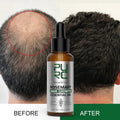 Rosemary Hair Growth Essential Oil