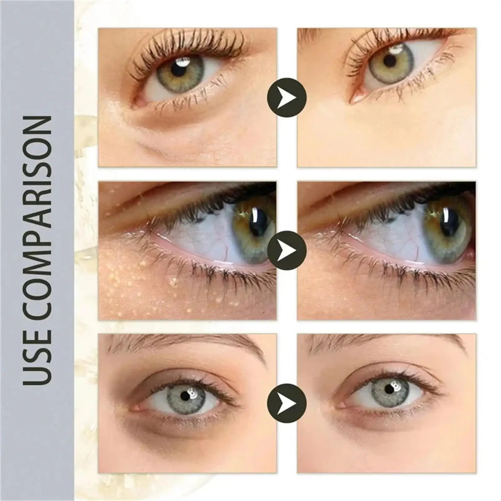 Under-Eye Granule Removal Serum
