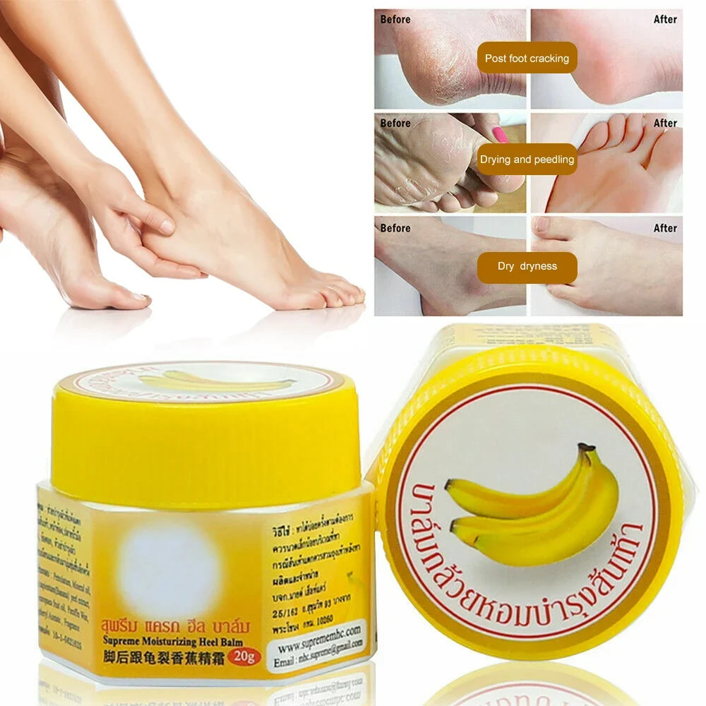 Dead Skin Remover Crack Cream