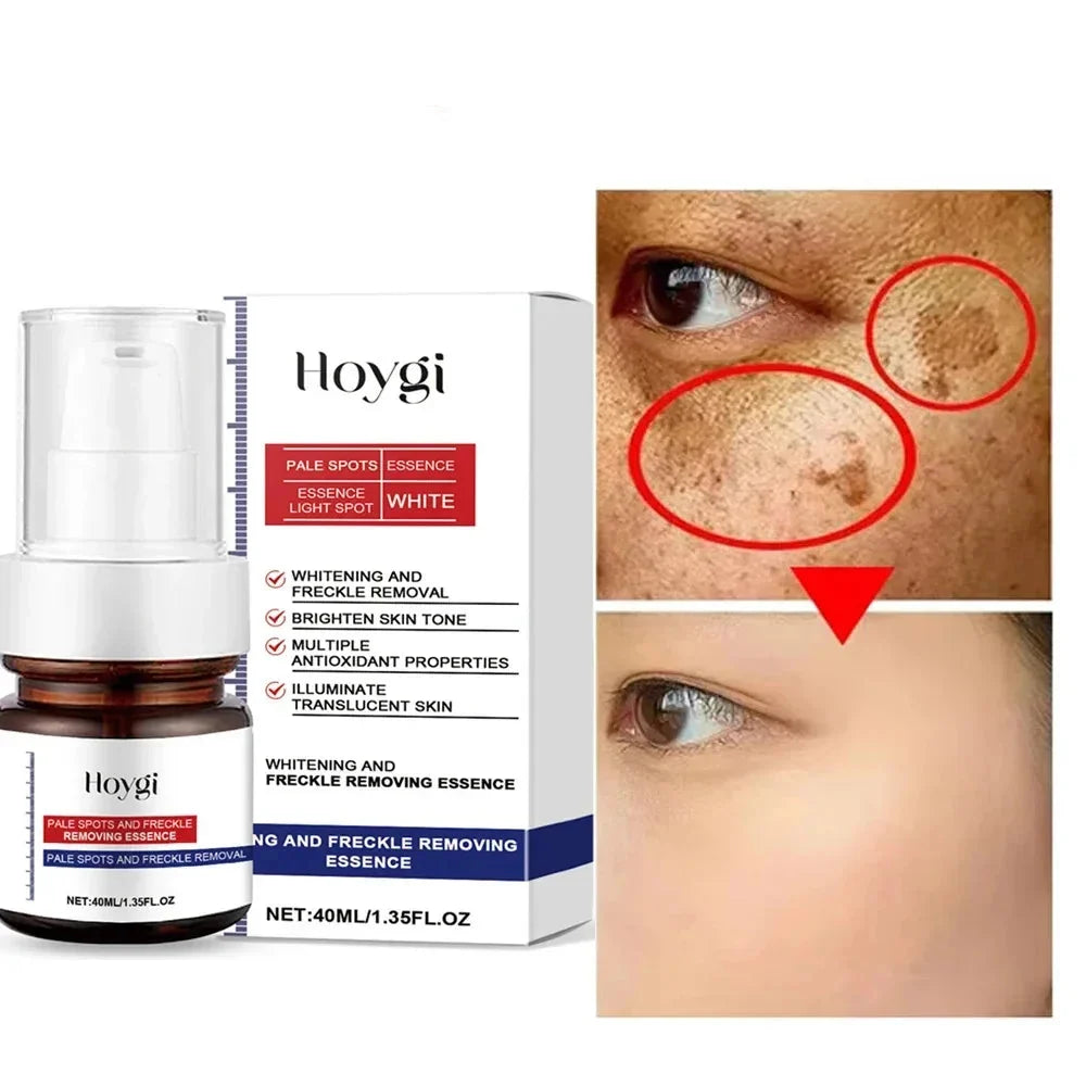Moisturizing Dark Spots Remover