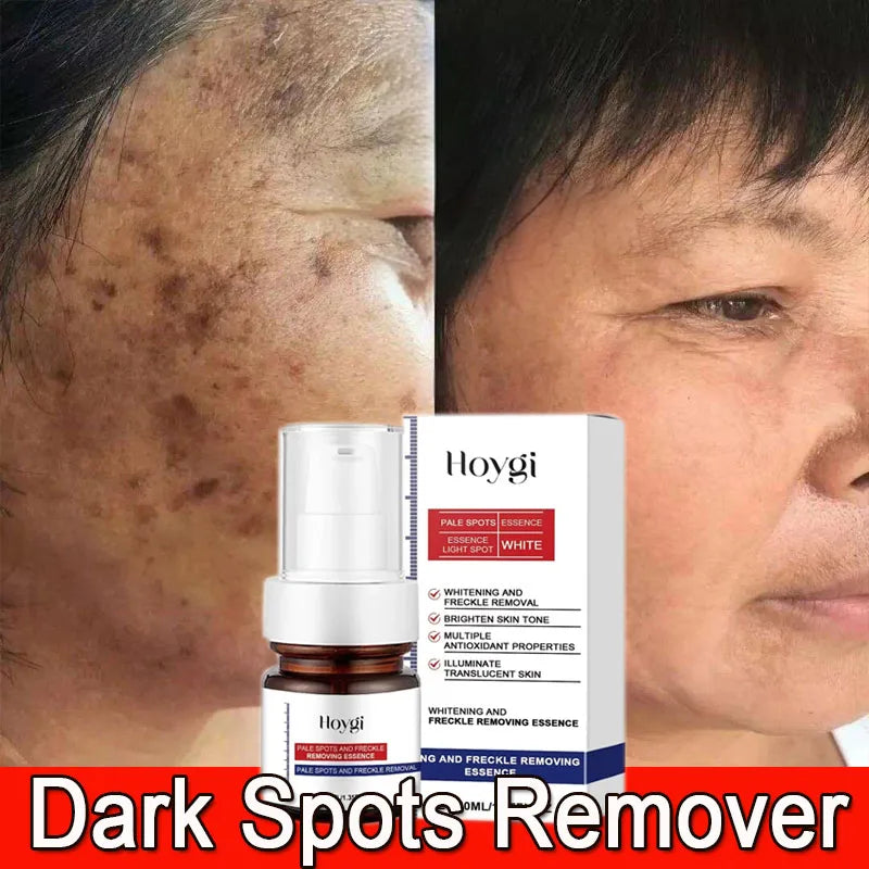 Moisturizing Dark Spots Remover