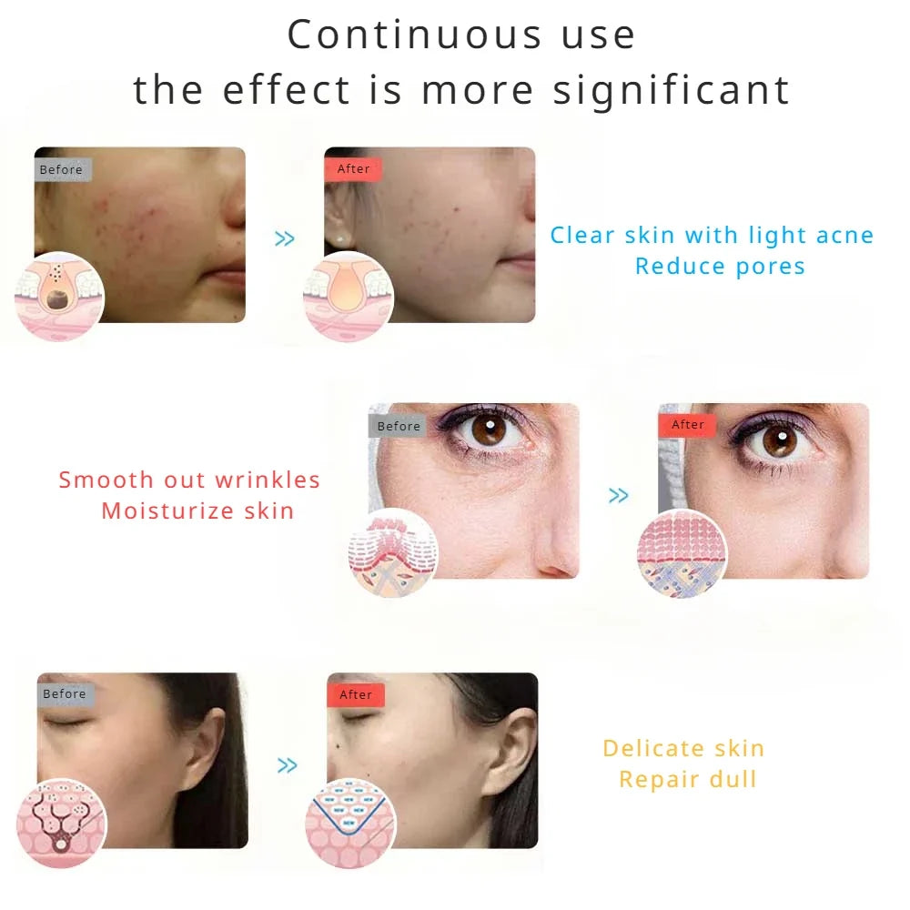 LED Red Light Therapy Facial Mask