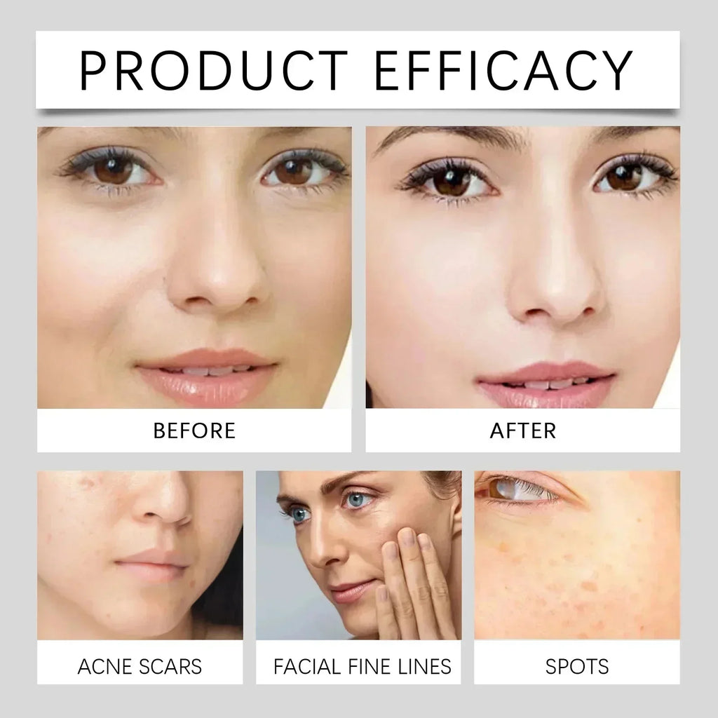 Moisturizing Dark Spots Remover