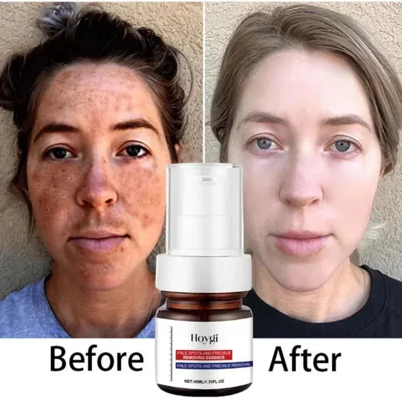 Moisturizing Dark Spots Remover