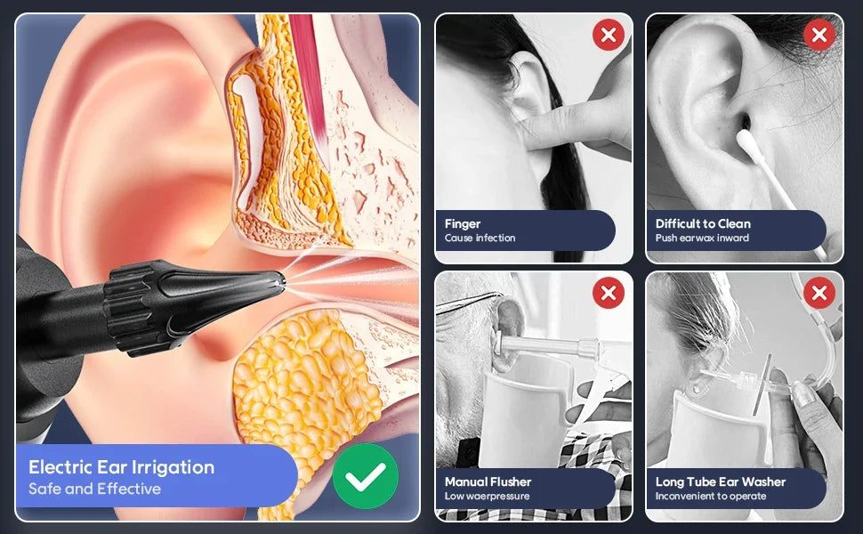 Electric Ear Wax Removal Kit