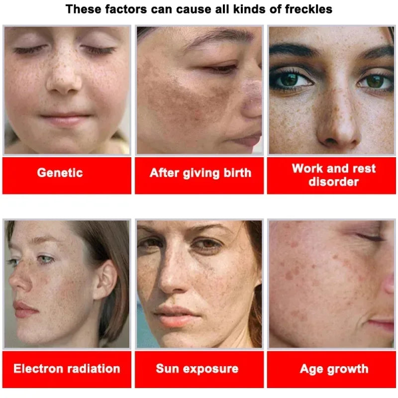 Moisturizing Dark Spots Remover